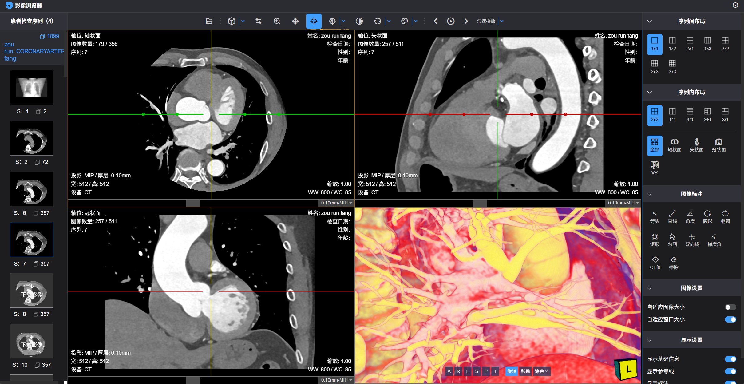 信创PACS解决方案